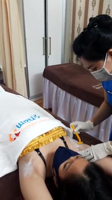 Quy trình triệt lông nách công nghệ Diode laser của khách hàng nữ lần thứ 3.