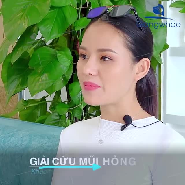 SỬA MŨI BIẾN CHỨNG LỘ SÓNG, LỆCH SÓNG - GANGWHOO ĐÃ GIÚP CÔ ẤY THĂNG HẠNG TỰ TIN NHƯ THẾ NÀO?