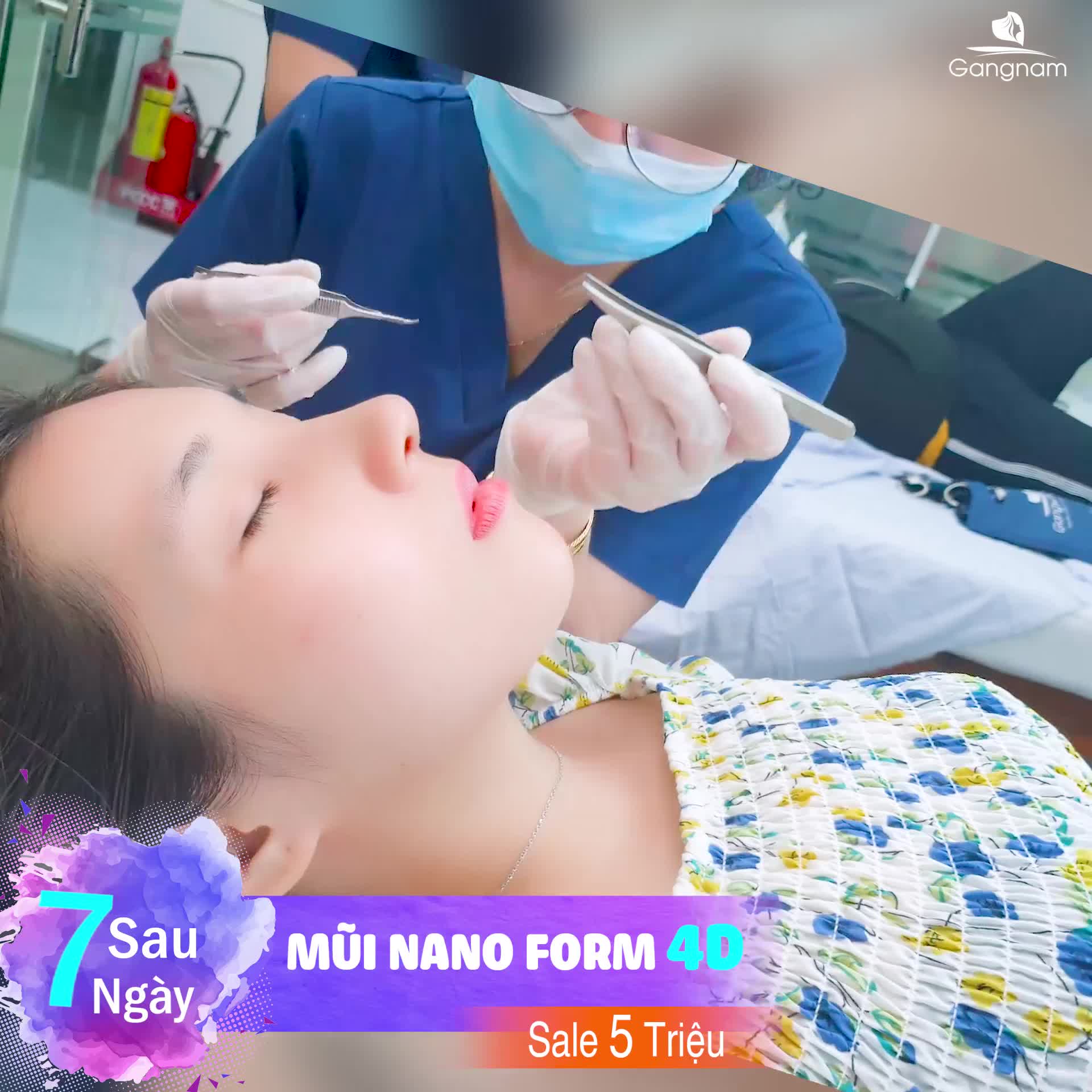 THÁO SỤN SAU NÂNG MŨI CÓ KHÓ KHÔNG?