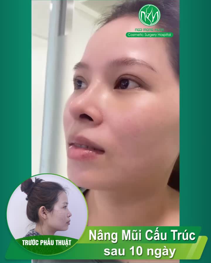 DÁNG MŨI THỜI THƯỢNG DÀNH CHO CÁC QUÝ CÔ