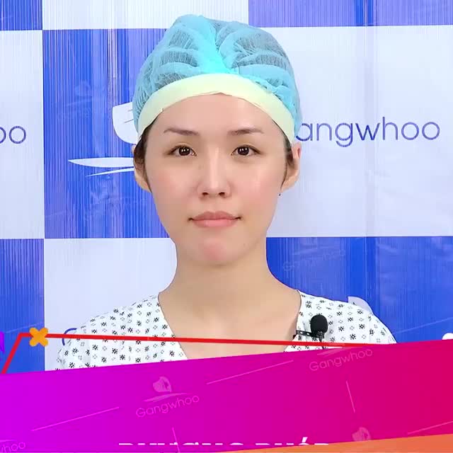 KHẮC PHỤC MŨI ĐÃ SỬA 7 NĂM BỊ TỤT SÓNG, LỘ SỤN, BÓNG ĐỎ ĐẦU MŨI