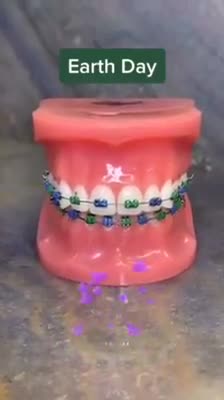 Nếu bạn đã quá nhàm chán với màu trắng bạc của dây thun và mắc cài, sao không thử thêm một chút "trang sức" đính kèm