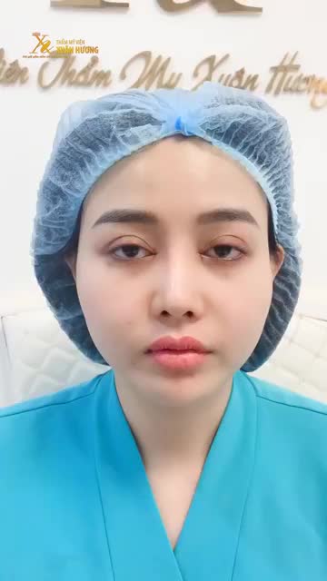 THU MÔI XONG MÀ NHẸ NHÀNG NHƯ KHÔNG, VỪA KHÔNG ĐAU LẠI THẤY NGAY KẾT QUẢ