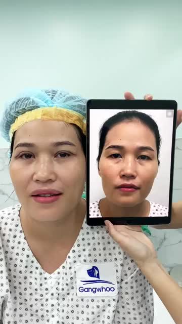 Đôi MẮT 4in1 cực kì có hồn tạo một điểm nhấn trên đôi mắt thôi mà nhìn gương mặt vui tươi lên rất nhiều không còn buồn như đôi mắt cũ