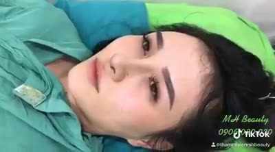 Ưu đãi ngập tràn đến 30% tất cả dịch vụ nâng mũi và độn cằm cả nhà nha