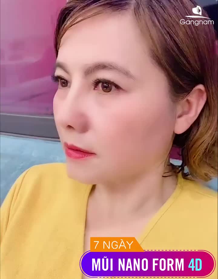3 SIÊU CỦA NÂNG MŨI NANO FORM TẠI NHÀ BÁC SĨ PARK BẠN ĐÃ BIẾT?