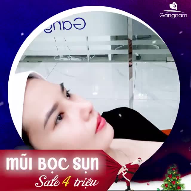 NÂNG MŨI BỌC SỤN TỰ THÂN CÓ MẮC KHÔNG?