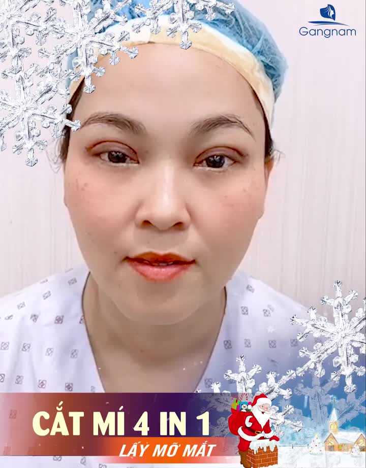 CẮT MÍ 4 IN 1 LÀ GÌ?