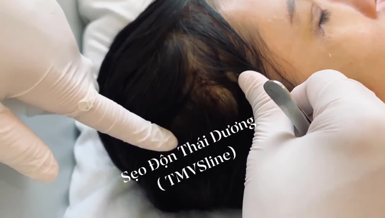 KHÁCH HÀNG ĐỘN THÁI DƯƠNG