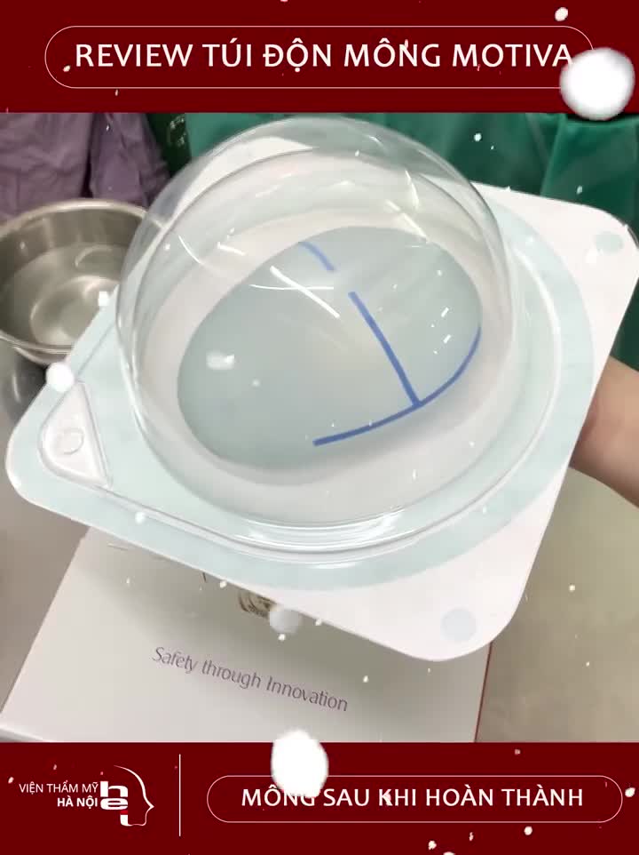 Đặt túi độn mông để đạt được một vòng 3 đẹp hoàn hảo mà không mất rất rất nhiều thời gian luyện tập.