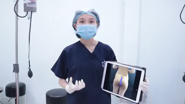 ĐÂY LÀ CÁCH BÁC SĨ BỆNH VIỆN EMCAS NÂNG MÔNG BẰNG PHƯƠNG PHÁP ĐẶT TÚI KẾT HỢP CẤY MỠ TỰ THÂN