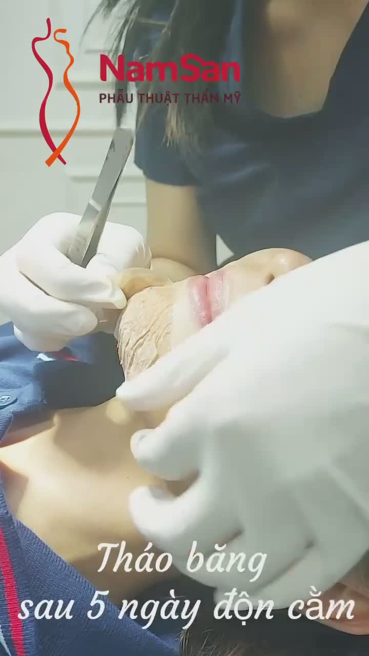 Tháo băng nẹp sau 5 ngày độn căm cắt vít nội sinh