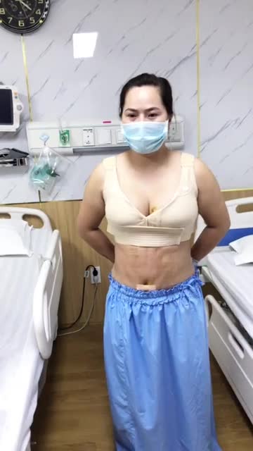 Kết quả siêu bất ngờ lấy lại vóc dáng thần tốc sexy sau khi thực hiện LIPO BỤNG TẠO HÌNH kết hợp CẤY NGỰC  tại BV THẨM MỸ ĐÔNG Á SG