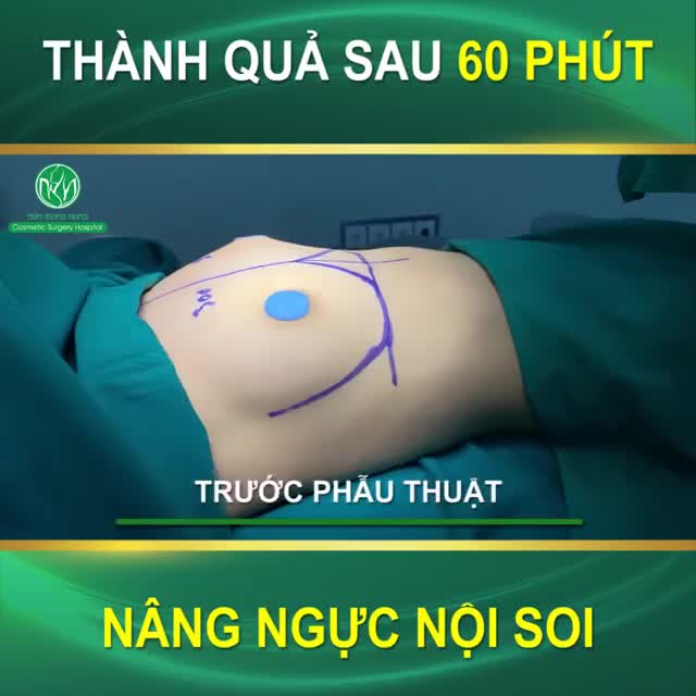 Sắp đến Tết rồi! Chị em đã sẵn sàng Để "tân trang" vòng 1 của mình chưa ạ!