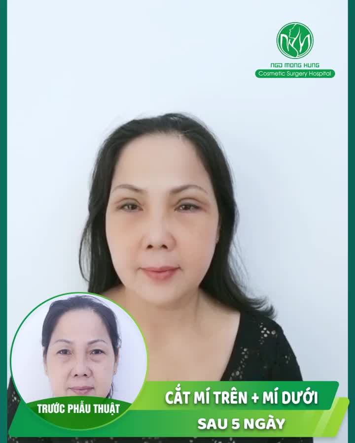 MÍ ĐẸP MÍ XINH TỰ TIN ĐÓN TẾT