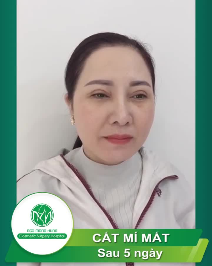 ️CHỊ KHÁCH THỨ 5 ĐẾN CẮT CHỈ TRONG SÁNG NAY
