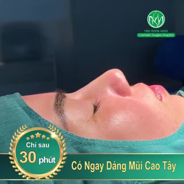 CẬN CẢNH DÁNG MŨI VỪA HOÀN THÀNH TẠI PHÒNG PHẪU THUẬT