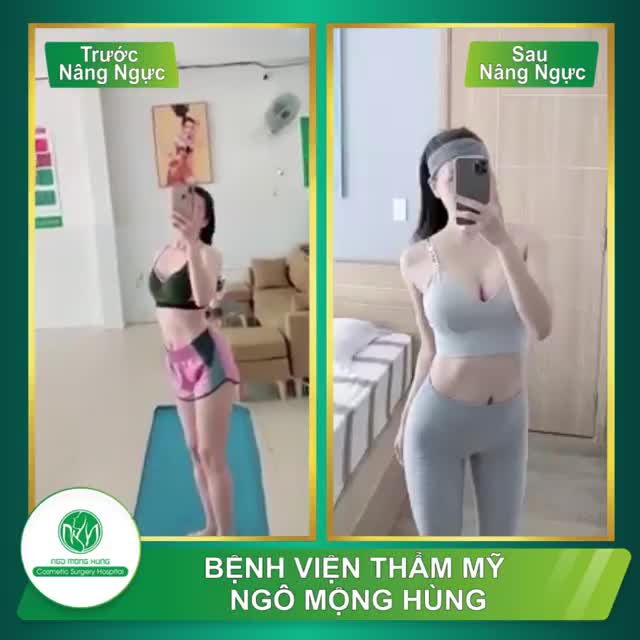 Với clip xinh xỉu đến từ Thu Thủy Cô nàng nâng ngực được 1 tháng tại bệnh viện.