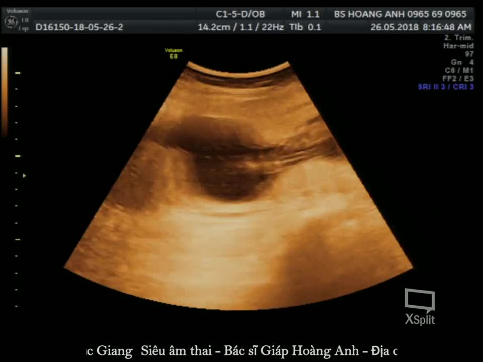 Con gái của bạn HOÀNG THỊ HOÀI