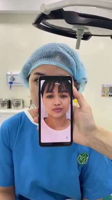 CẬN CẢNH KẾT QUẢ NGAY SAU NÂNG MŨI