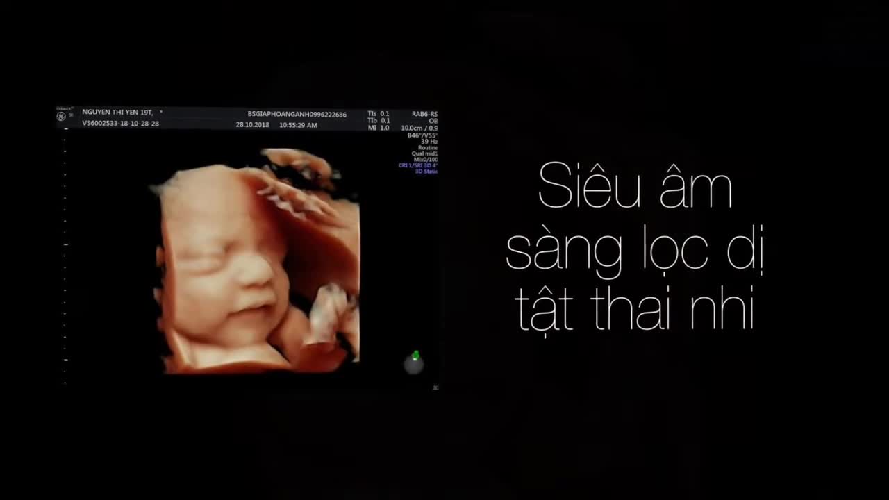 Siêu âm thai ở Bắc Giang - Bs Giáp Hoàng Anh