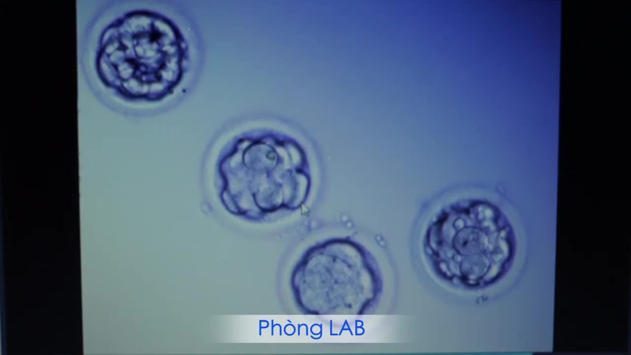 BVĐK Tâm Anh ứng dụng TRÍ TUỆ NHÂN TẠO (AI) nuôi phôi trong điều trị vô sinh hiếm muộn: nâng cao chất lượng phôi, tăng tỷ lệ thành công, sàng lọc không xâm lấn.