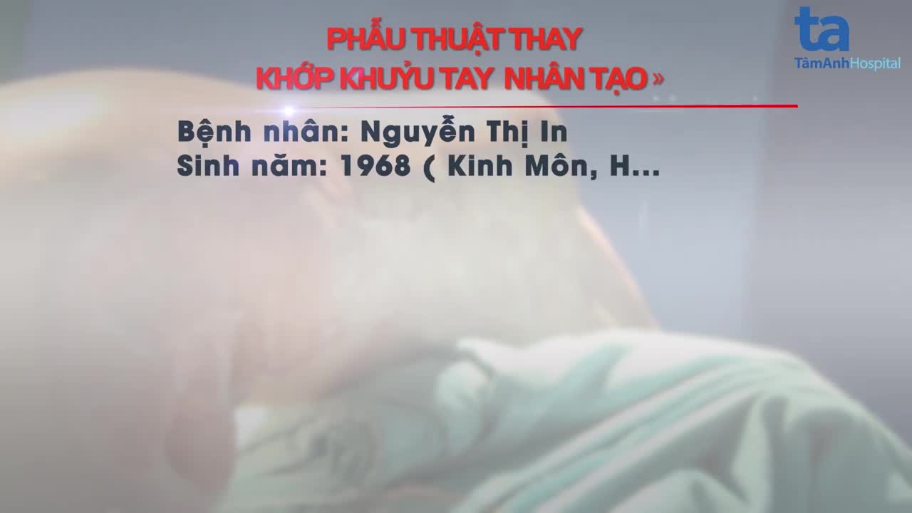 LẦN ĐẦU TIÊN TẠI VIỆT NAM: THAY KHỚP KHUỶU TOÀN PHẦN, KHÔI PHỤC CHỨC NĂNG VẬN ĐỘNG CÁNH TAY TÀN PHẾ CHO BỆNH NHÂN BỊ TAI NẠN GIAO THÔNG