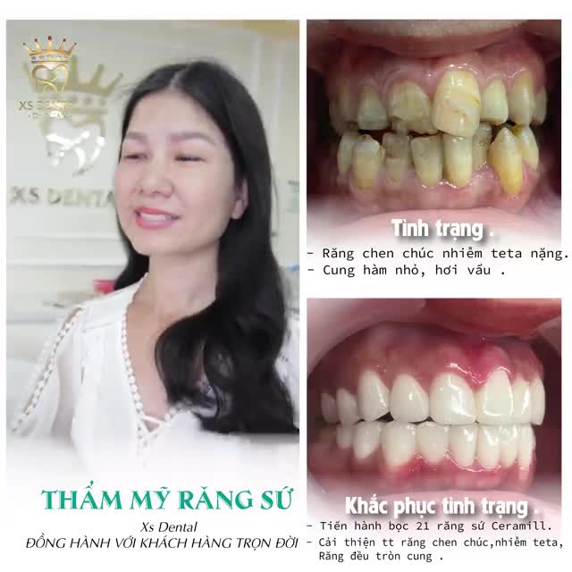 Hoàn thành ca thẩm mỹ cho cô khách hàng đã thay đổi hoàn toàn diện mạo của chính mình chỉ sau 24 giờ .