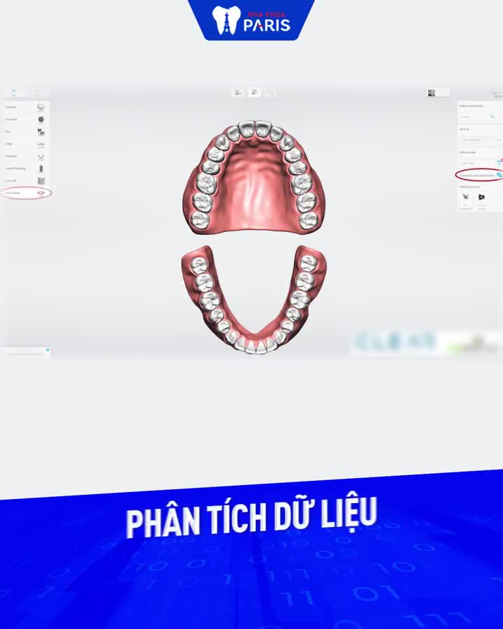 HOTTT! TRIOS 3D - CÔNG NGHỆ NHA KHOA TÂN TIẾN NHẤT TỪ CHÂU ÂU ĐÃ CẬP BẾN TẠI NHA KHOA PARIS