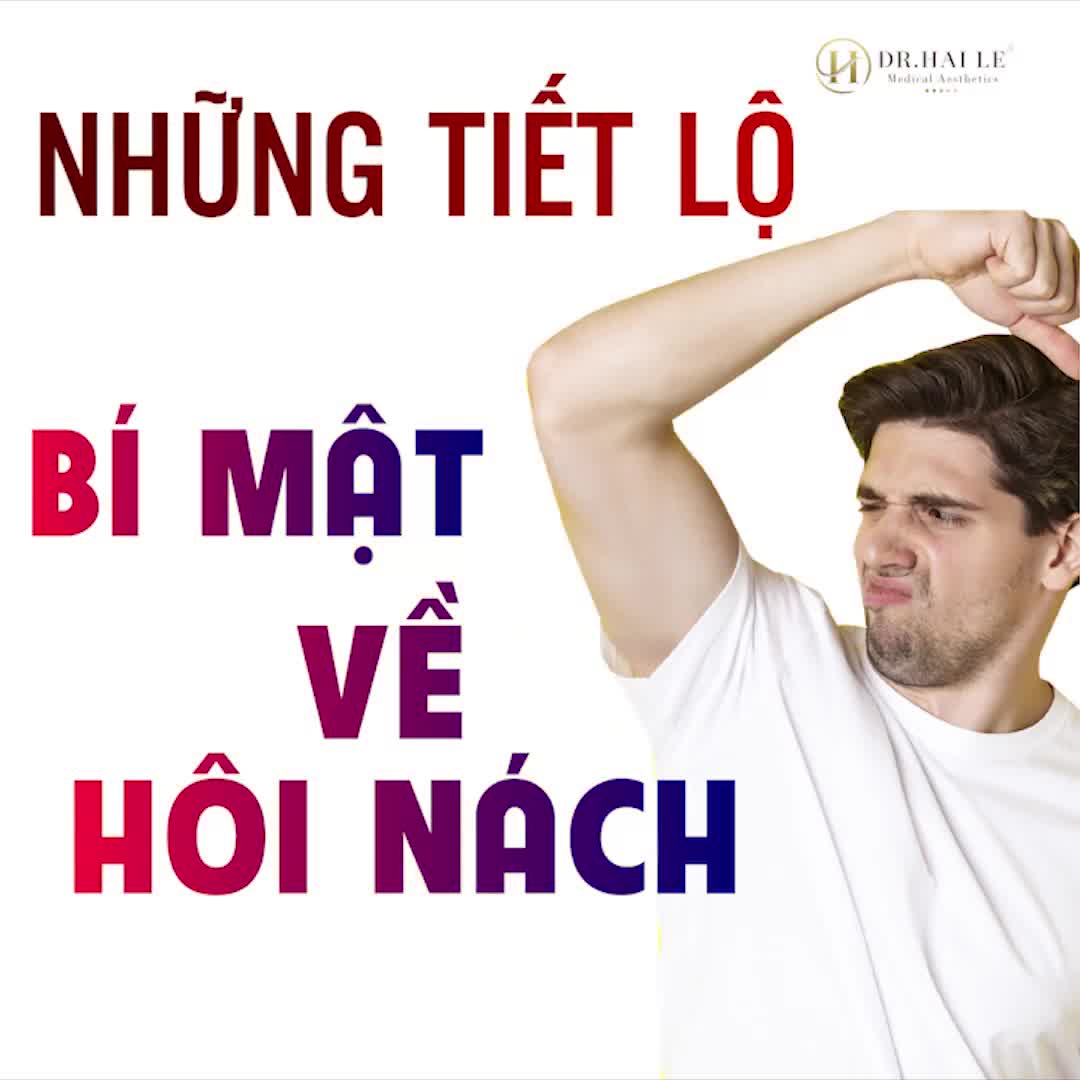 Những câu chuyện "dở khóc dở cười" bắt nguồn từ hôi nách