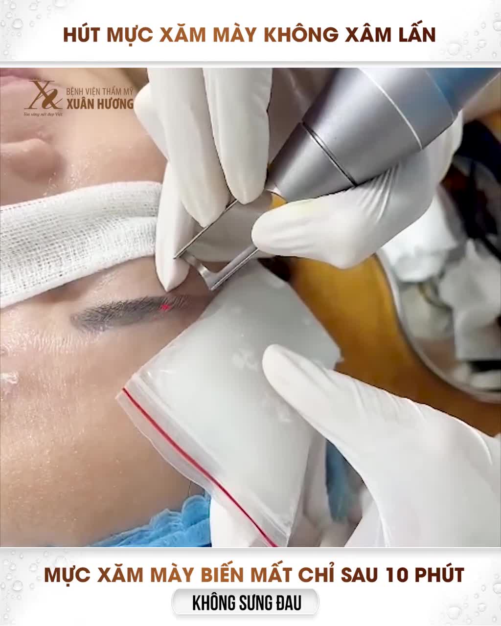 HÚT MỰC XĂM MÀY THẤY RÕ HIỆU QUẢ KHI DI MÁY, VỪA AN TOÀN LẠI KHÔNG XÂM LẤN