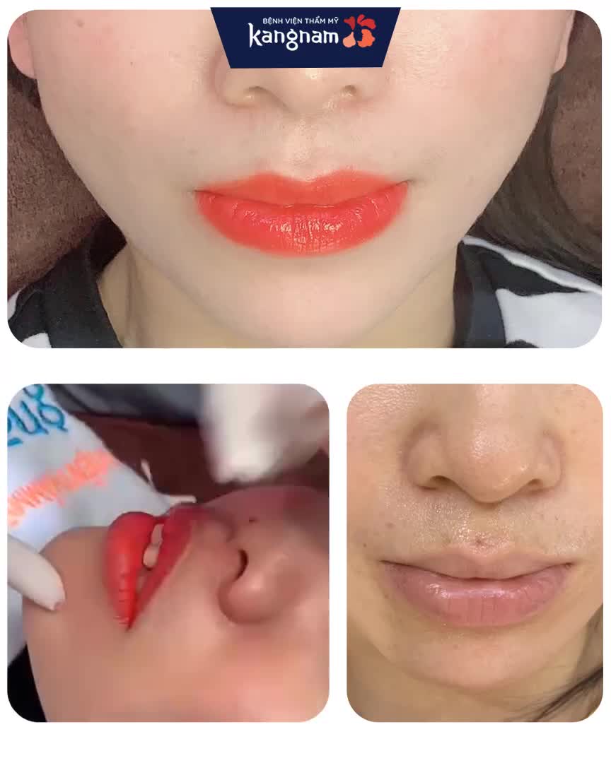 PHUN MÔI Nano: Vừa phun KHÔNG SƯNG - MÀU TRONG TRẺO