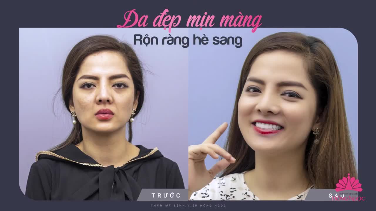 DA ĐẸP MỊN MÀNG RỘN RÀNG HÈ SANG
