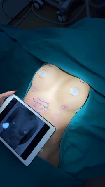 SIÊU PHẨM "KIẾN TẠO" BODY THỰC HIỆN BỞI EKIP SLINE SAU 180 PHÚT