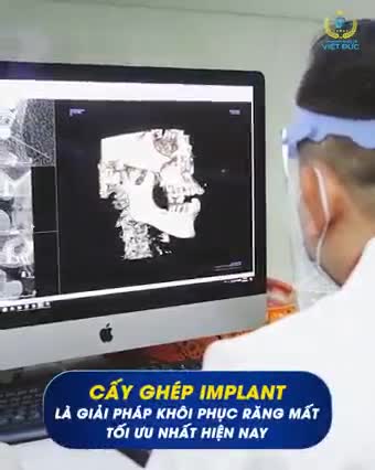 CÁC LOẠI TRỤ IMPLANT TỐT NHẤT HIỆN NAY