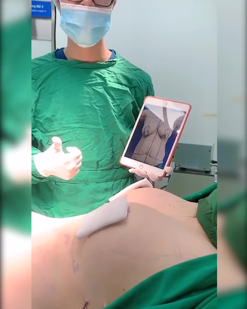 Đẹp xuất sắc với siêu phẩm Nâng Ngực + Treo sa trễ kết hợp Hút mỡ + Tạo hình thành bụng của mẹ 3 con