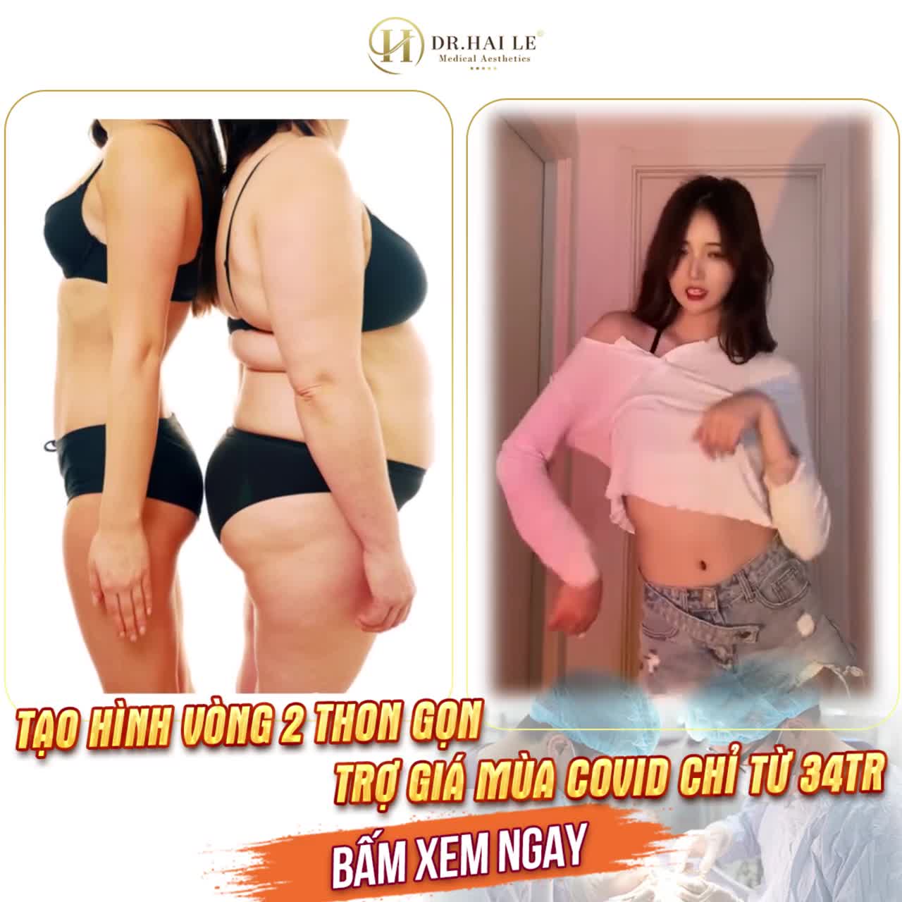 Đừng để m.ỡ thừa khiến bạn tự ti!