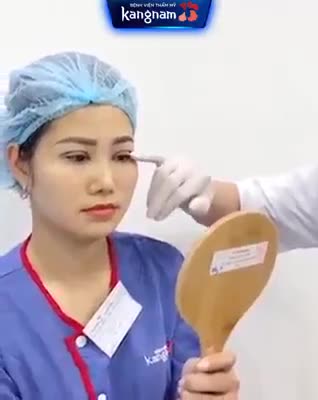 Vừa Cắt Mí xong - Có sưng không?