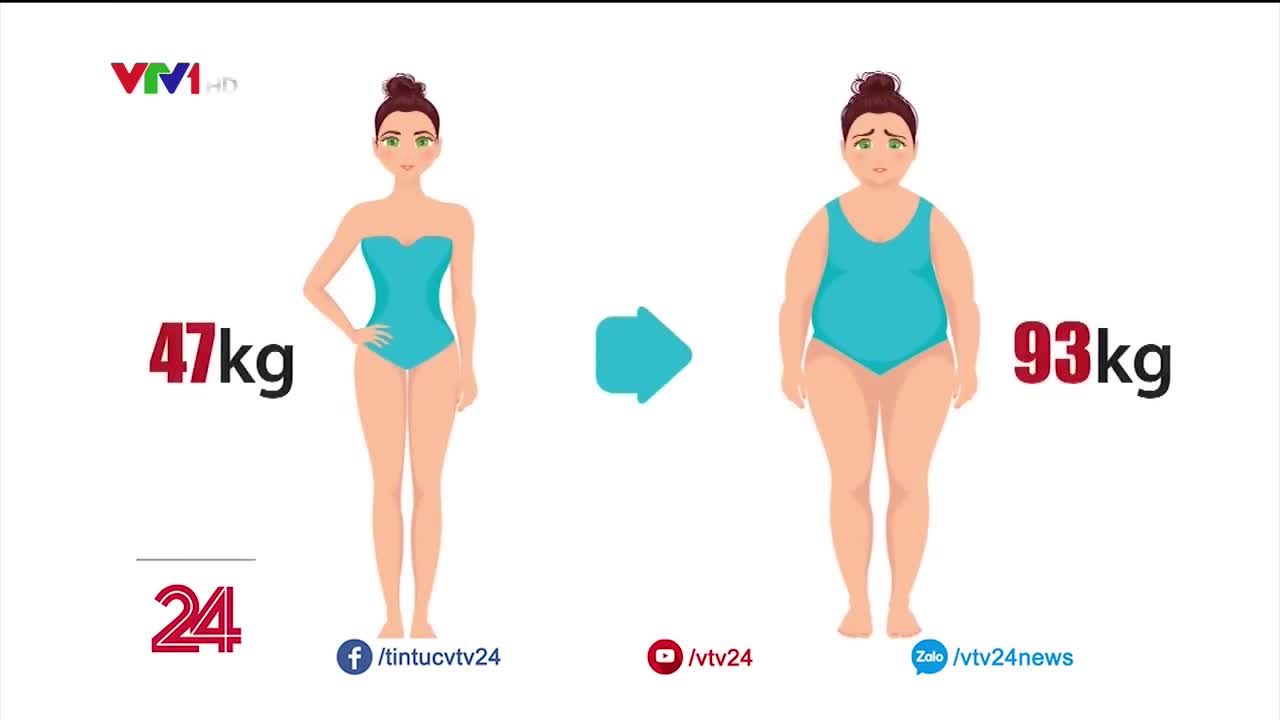 Giảm béo bằng phương pháp phẫu thuật nội soi thu nhỏ dạ dày