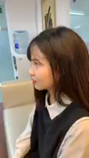 Khách hàng tái khám sau 6 tháng làm Combo mũi - mí tại Dr Ngọc Trung.
