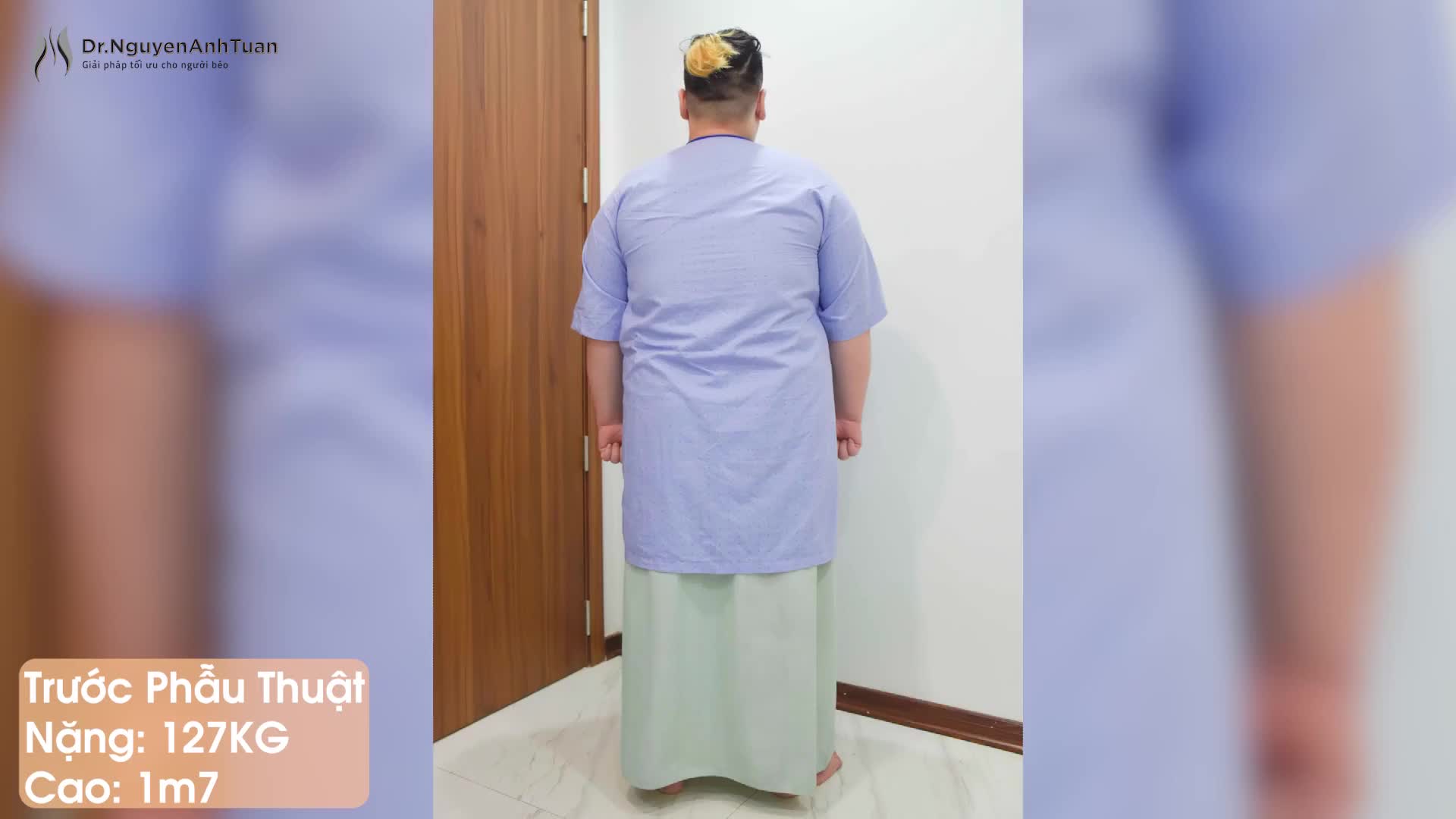 Giảm 40kg sau 10 tháng thực hiện Thu nhỏ Dạ dày - Bệnh nhân vui vẻ chia sẻ cùng PGS.TS. Nguyễn Anh Tuấn