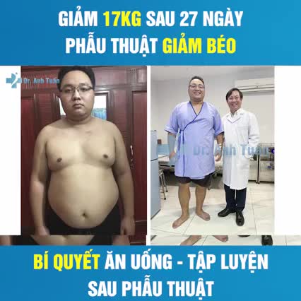GIẢM 17KG SAU 27 NGÀY PHẪU THUẬT NỘI SOI THU NHỎ DẠ DÀY