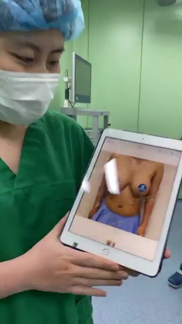 Kết quả ca HÚT MỠ BỤNG TRÊN, DƯỚI + EO, CĂNG DA MINI kết hợp TREO SA TRỄ độ 2 sau 2h phẫu thuật