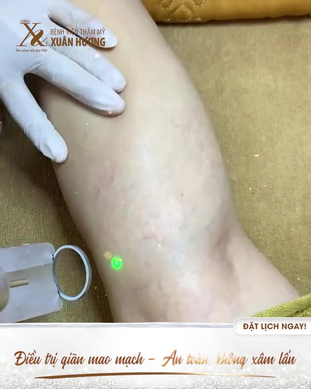 GIÃN MAO MẠCH XANH ĐỎ LỘ RÕ, "TỐ CÁO" LÀN DA YẾU ỚT