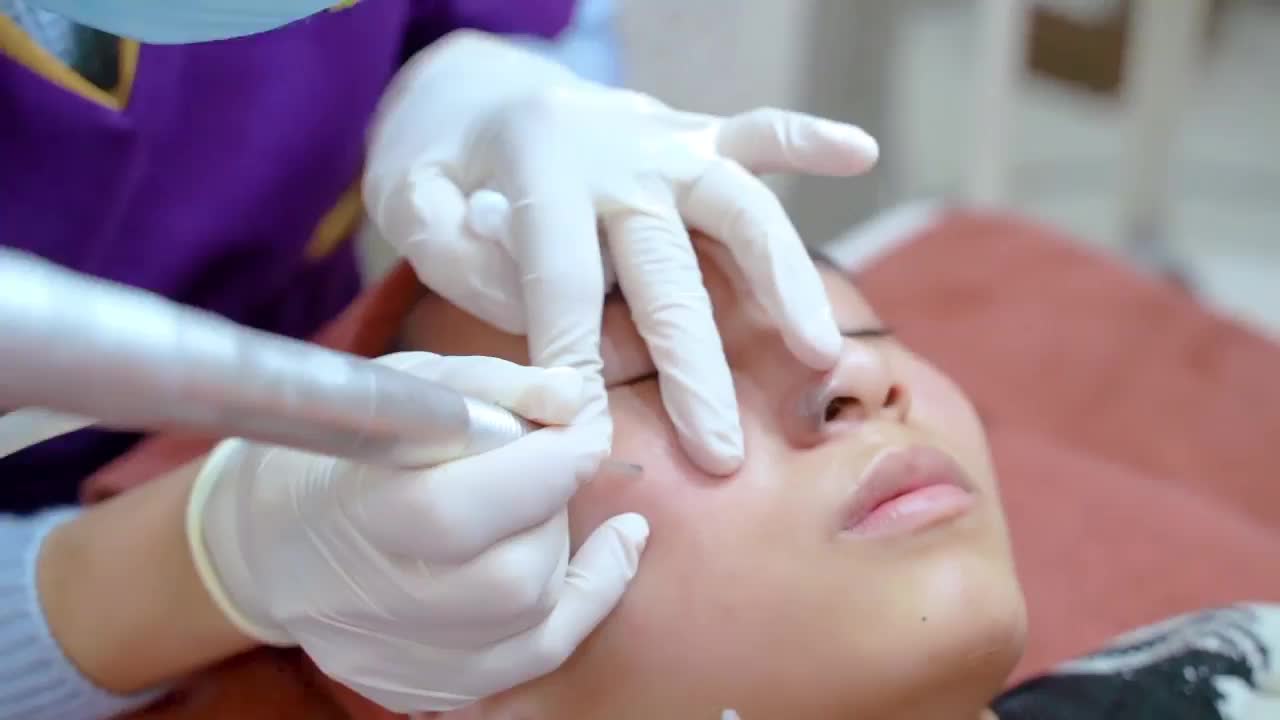 Tẩy nốt ruồi phá tướng chuẩn bị đón Tết thêm xinh nào cả nhà ơi