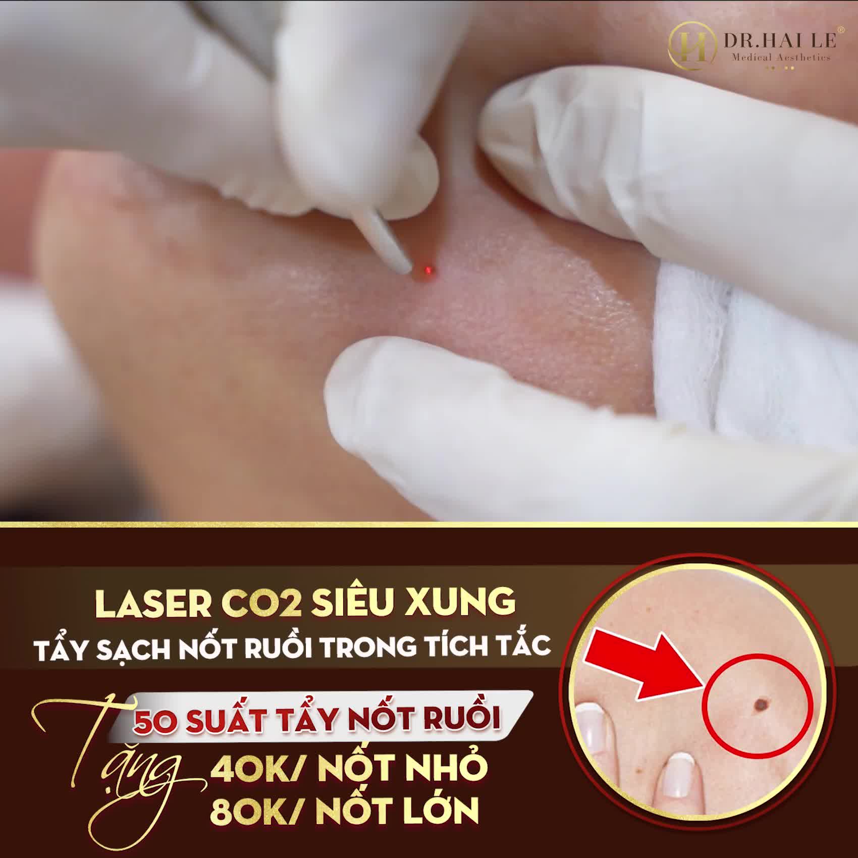 Sao mẹ chị để cái nốt ruồi ở gần miệng trông giống dì ghẻ thế đấy là Admin đã nghe được câu chuyện của 2 em bé, thơ ngây mà cũng đáng yêu lắm luôn í.
