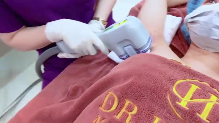 Trị hôi nách bằng công nghệ miraDry là công nghệ đầu tiên hiệu quả và an toàn nhất hiện nay