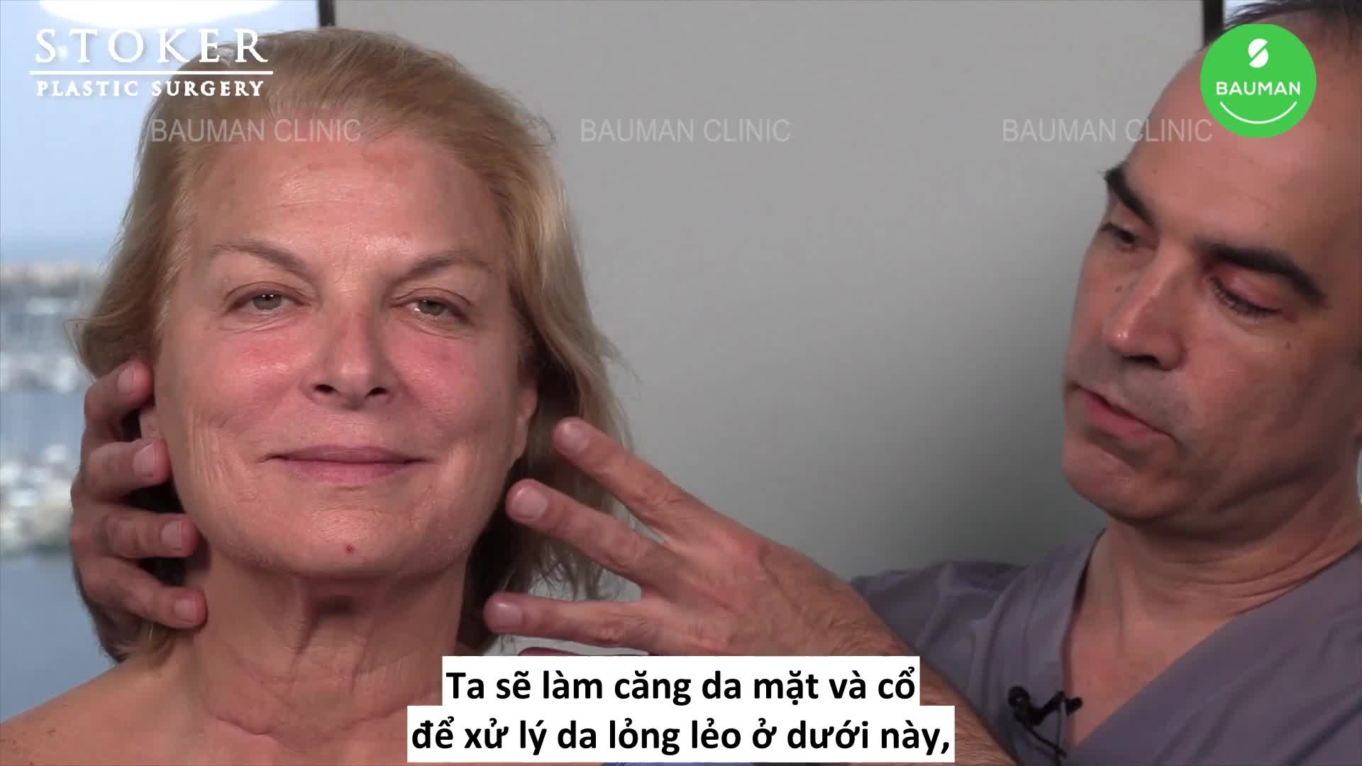 5 tuần sau căng da mặt cổ rất đẹp và tự nhiên, nữ 66 tuổi