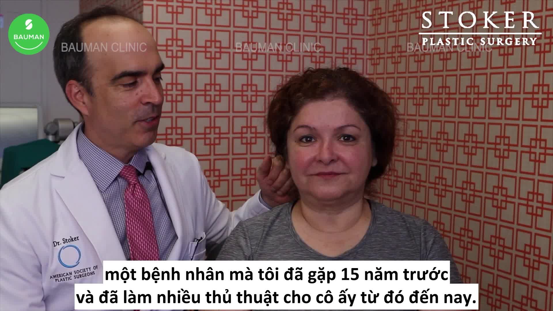 Lấy túi mỡ má và căng da mặt dưới