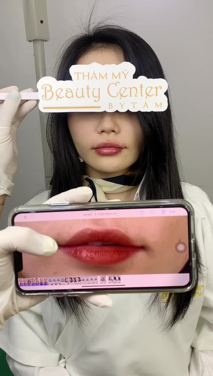Tạo hình môi cho chị khách hàng gặp tình trạng môi mỏng, hai môi không cân đối. Kết quả bất ngờ dau 15 phút thực hiện